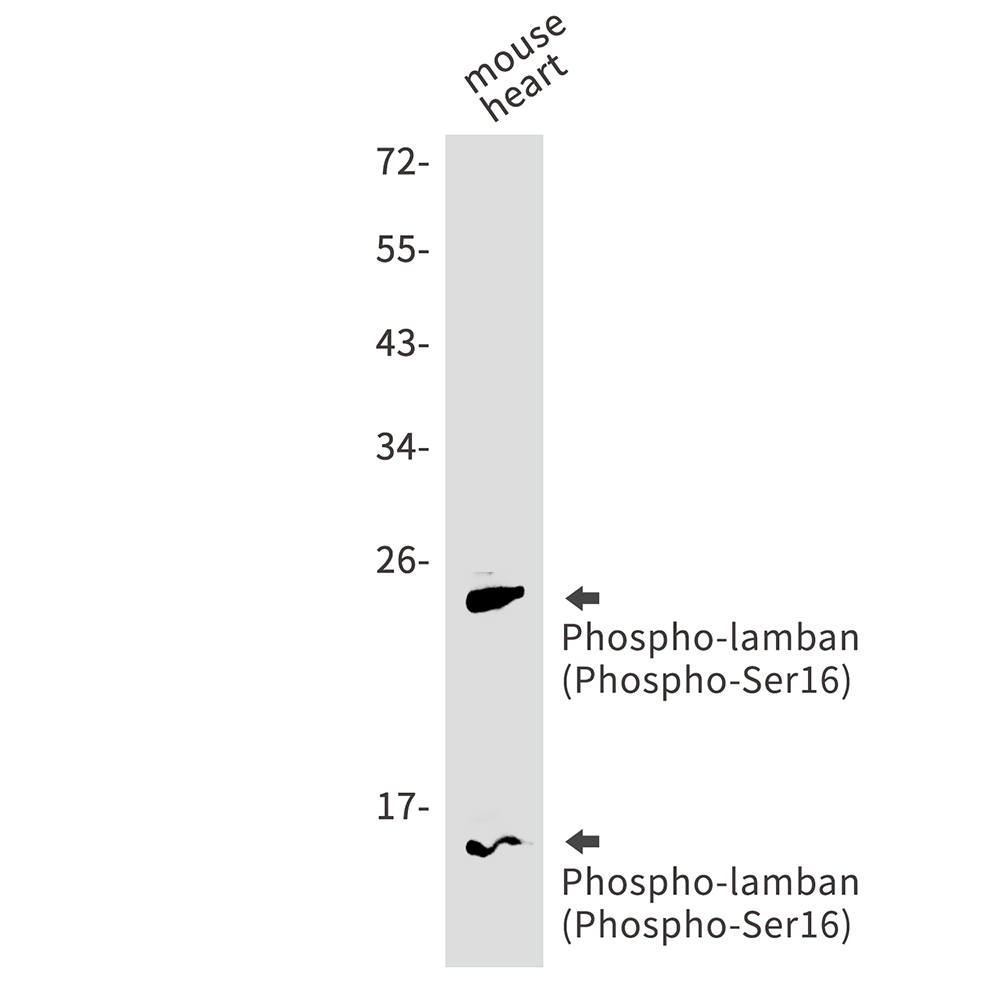 Rabbit Monoclonal Antibody to Phospho-Phospholamban (Ser16)