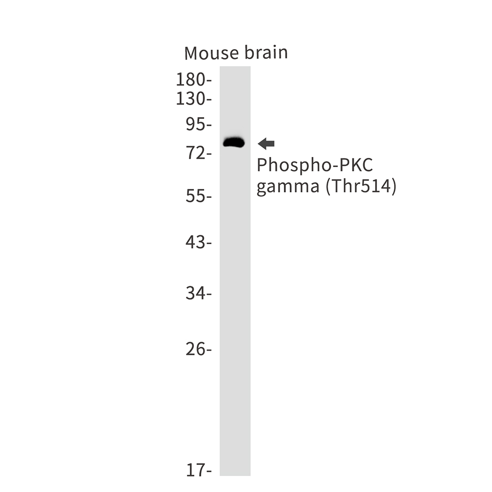 Rabbit Monoclonal Antibody to Phospho-PKC gamma (Thr514)