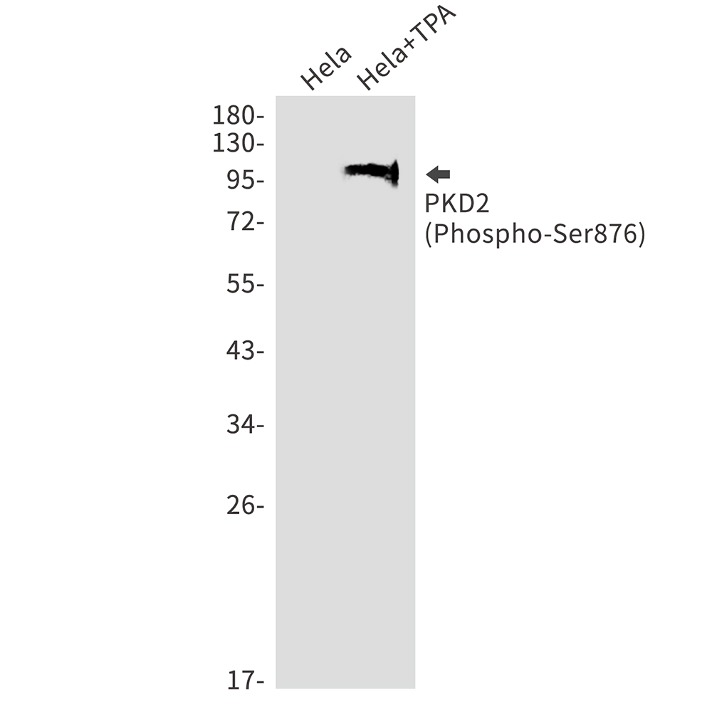 Rabbit Monoclonal Antibody to Phospho-PRKD2 (Ser876)