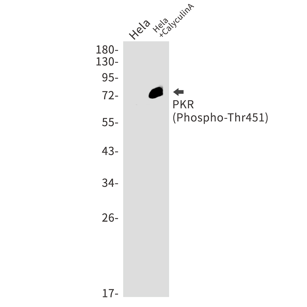 Rabbit Monoclonal Antibody to Phospho-PKR (Thr451)