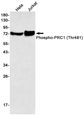 Rabbit Monoclonal Antibody to Phospho-PRC1 (Thr481)