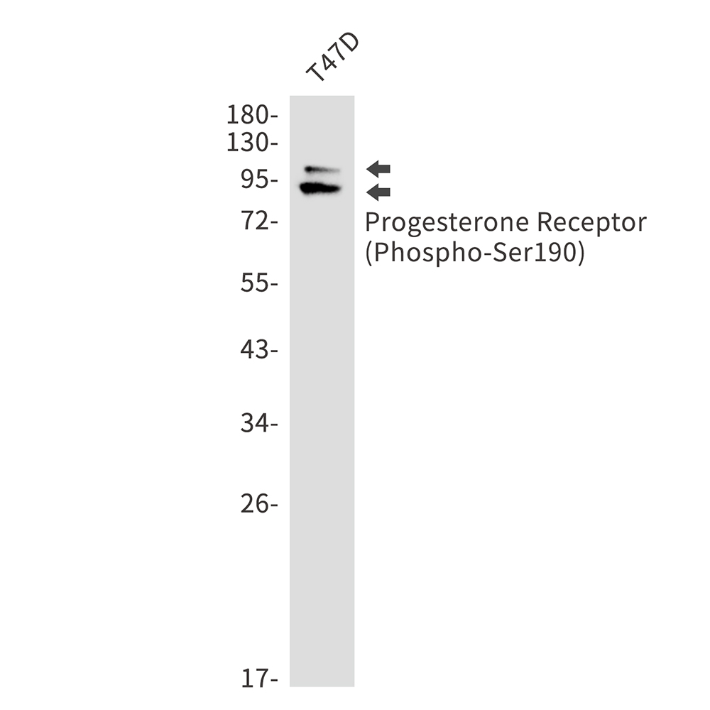 Rabbit Monoclonal Antibody to Phospho-Progesterone Receptor (Ser190)