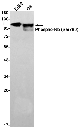 Rabbit Monoclonal Antibody to Phospho-Rb (Ser780)