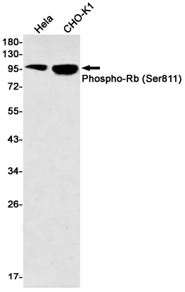 Rabbit Monoclonal Antibody to Phospho-Rb (Ser811)