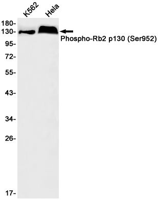 Rabbit Monoclonal Antibody to Phospho-Rb2 p130 (Ser952)