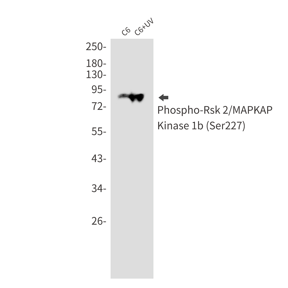 Rabbit Monoclonal Antibody to Phospho-RSK2 (Ser227)