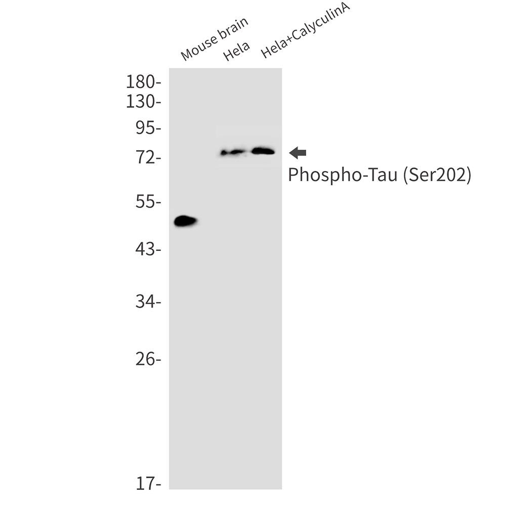 Rabbit Monoclonal Antibody to Phospho-Tau (Ser202)
