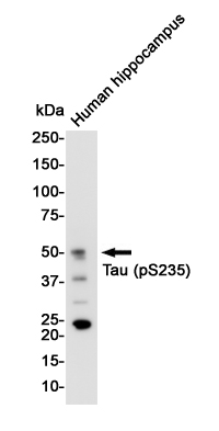 Rabbit Monoclonal Antibody to Phospho-Tau (Ser235)