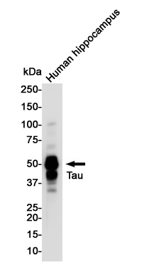Rabbit Monoclonal Antibody to Phospho-Tau (Thr50)