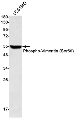 Rabbit Monoclonal Antibody to Phospho-Vimentin (Ser56)