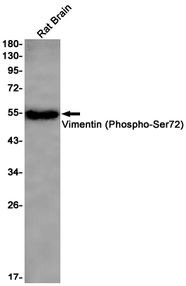 Rabbit Monoclonal Antibody to Phospho-Vimentin (Ser72)