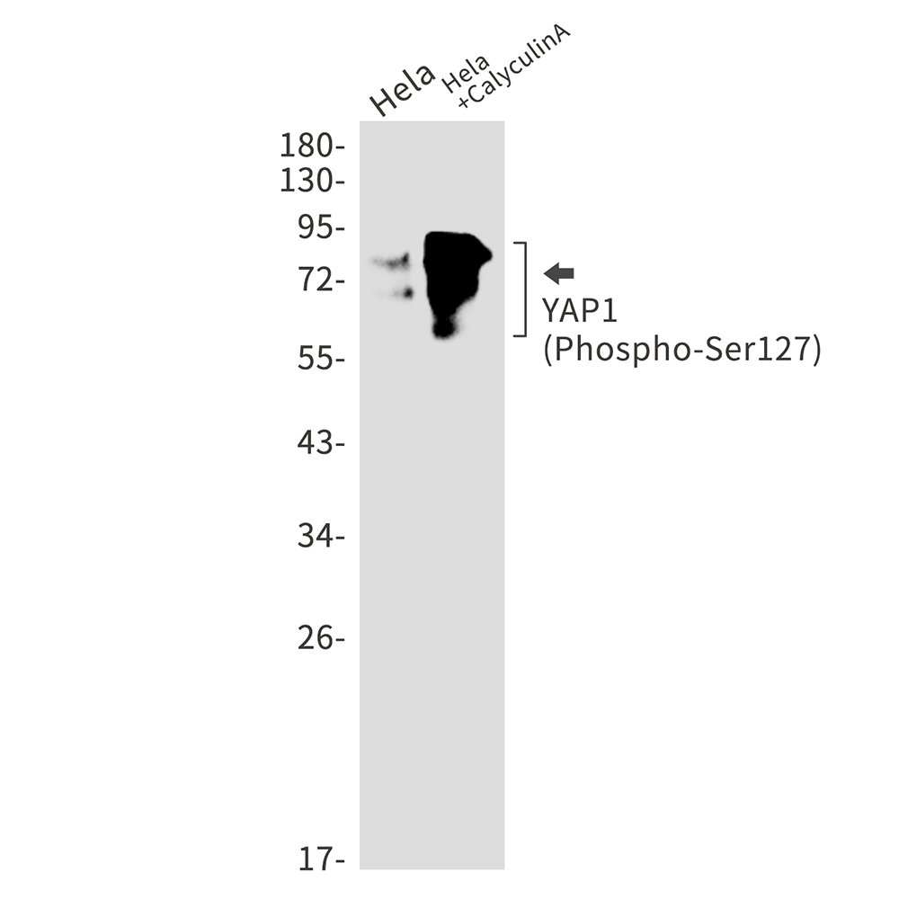 Rabbit Monoclonal Antibody to Phospho-YAP1 (Ser127)