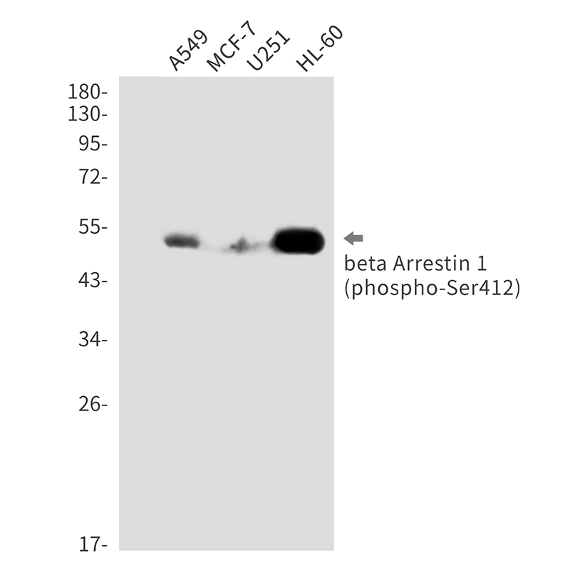 Rabbit Monoclonal Antibody to Phospho-beta Arrestin 1 (Ser412)