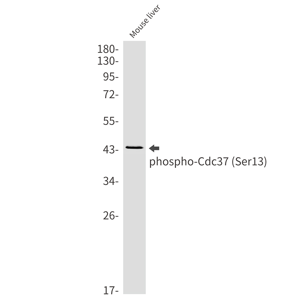 Rabbit Monoclonal Antibody to Phospho-CDC37 (Ser13)