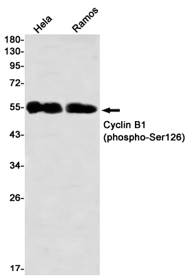 Rabbit Monoclonal Antibody to Phospho-Cyclin B1 (Ser126)