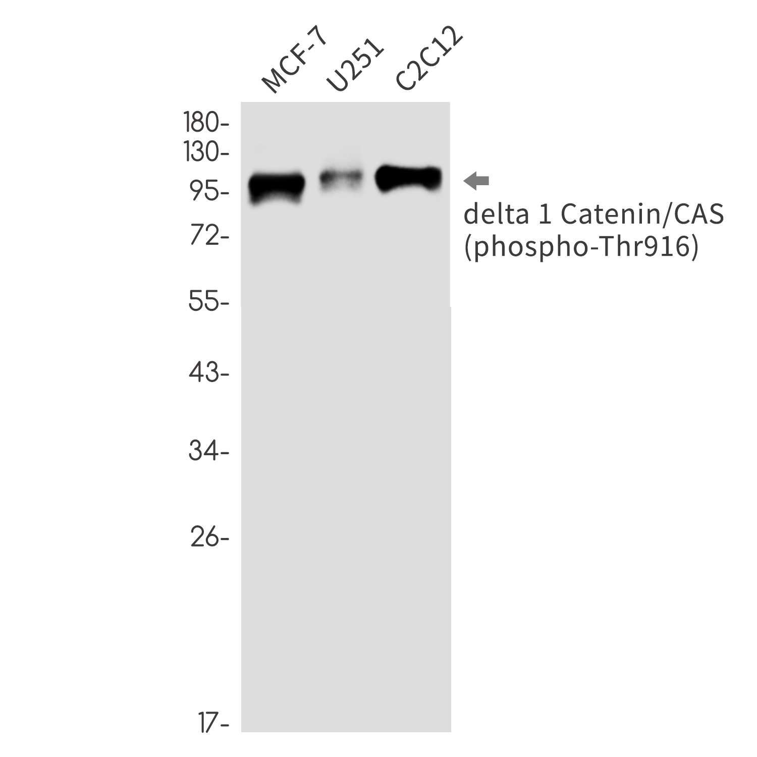 Rabbit Monoclonal Antibody to Phospho-delta 1 Catenin (Thr916)