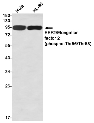 Rabbit Monoclonal Antibody to Phospho-Elongation Factor 2 (Thr56/Thr58)