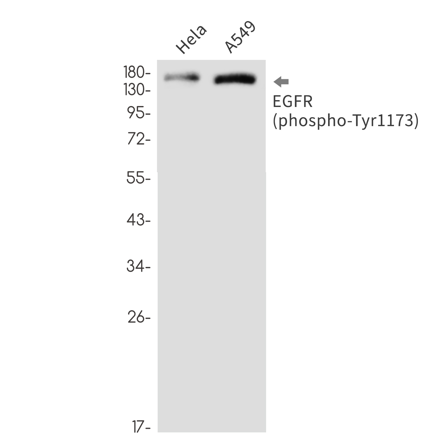 Rabbit Monoclonal Antibody to Phospho-EGFR (Tyr1173)