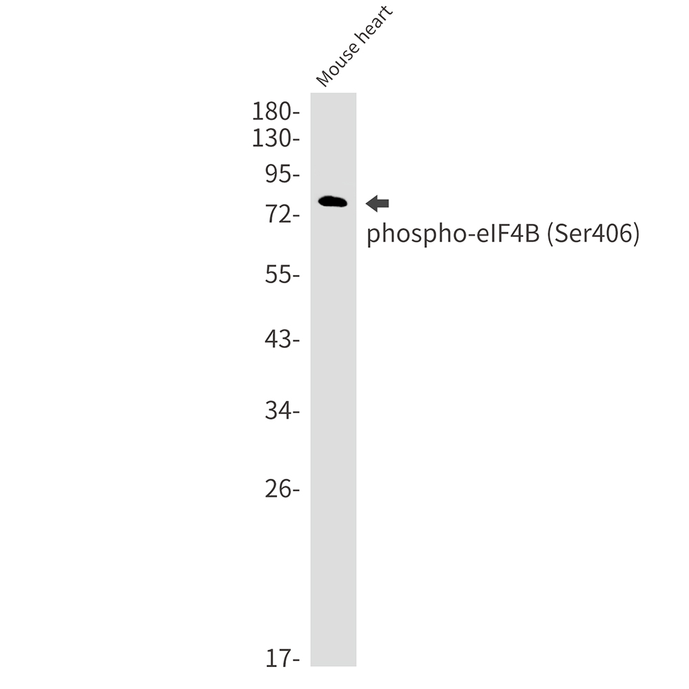 Rabbit Monoclonal Antibody to Phospho-eIF4B (Ser406)
