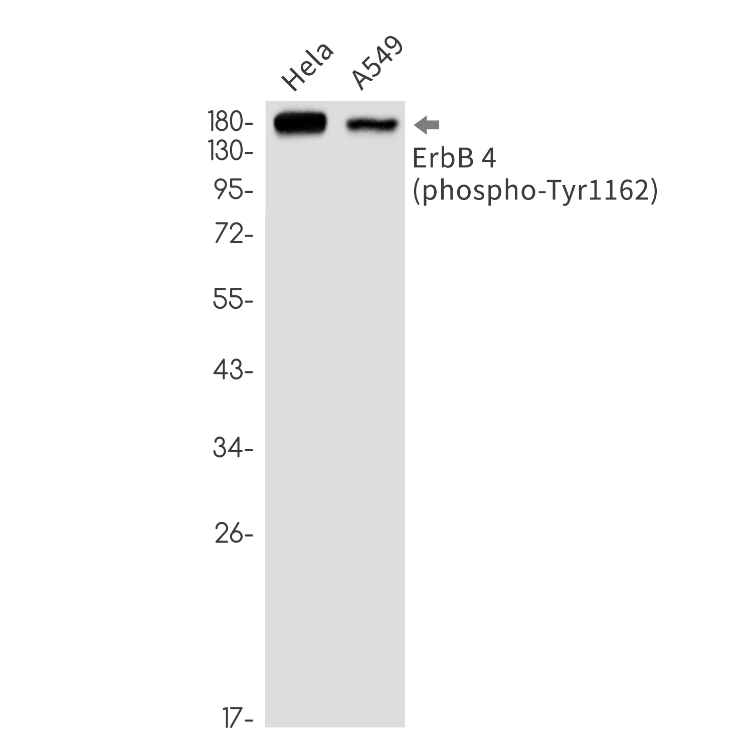 Rabbit Monoclonal Antibody to Phospho-ErbB 4 (Tyr1162)