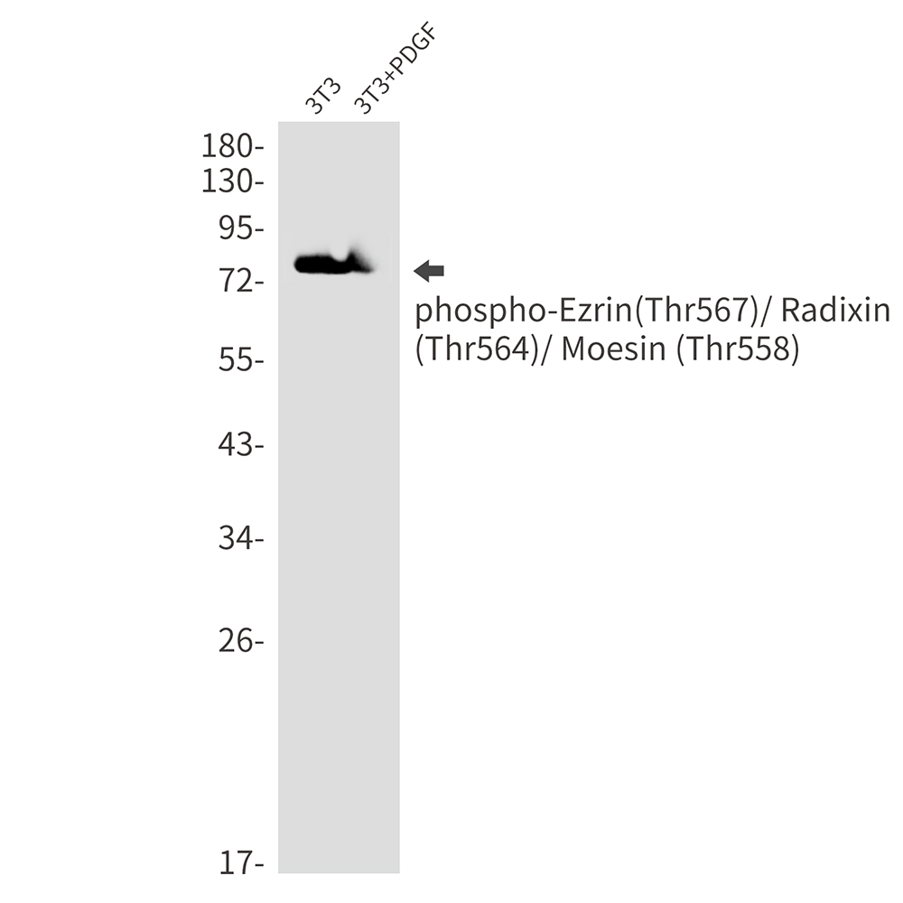 Rabbit Monoclonal Antibody to Phospho-Ezrin/Radixin/Moesin (Thr567/Thr564/Thr558)