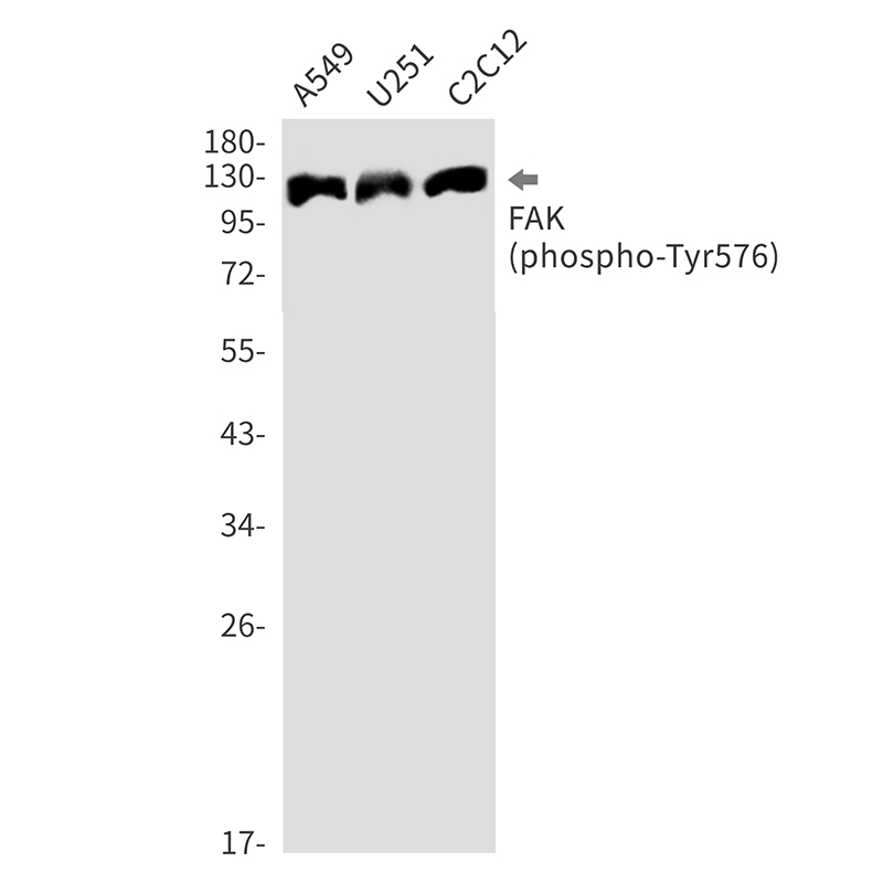 Rabbit Monoclonal Antibody to Phospho-FAK (Tyr576)
