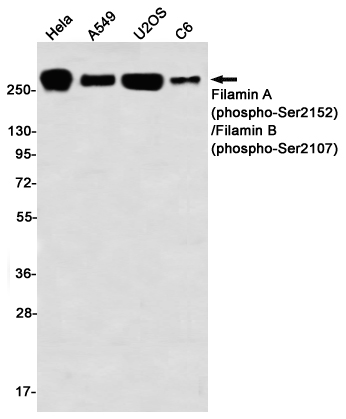 Rabbit Monoclonal Antibody to Phospho-Filamin A/B (Ser2152/Ser2107)