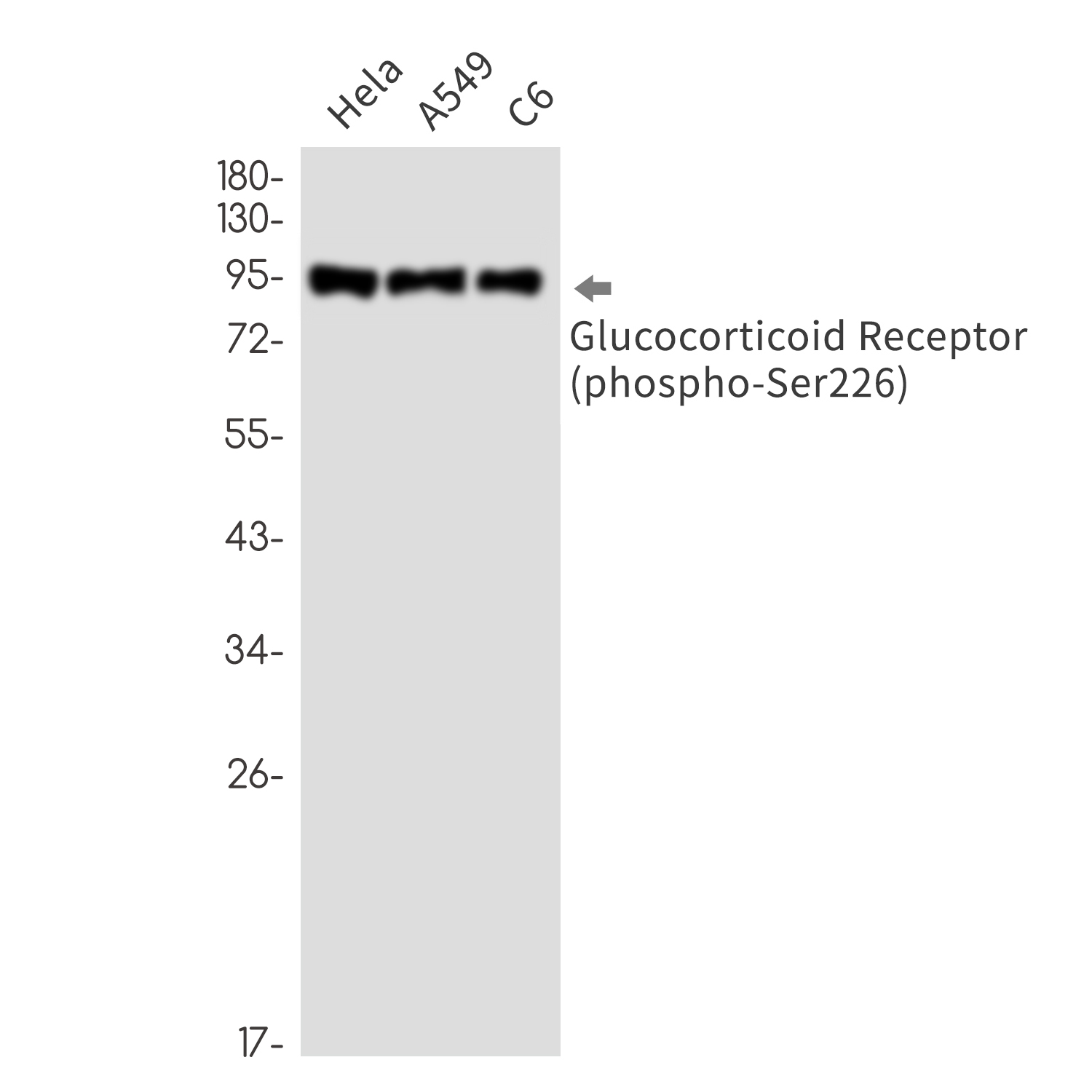 Rabbit Monoclonal Antibody to Phospho-Glucocorticoid Receptor (Ser226)