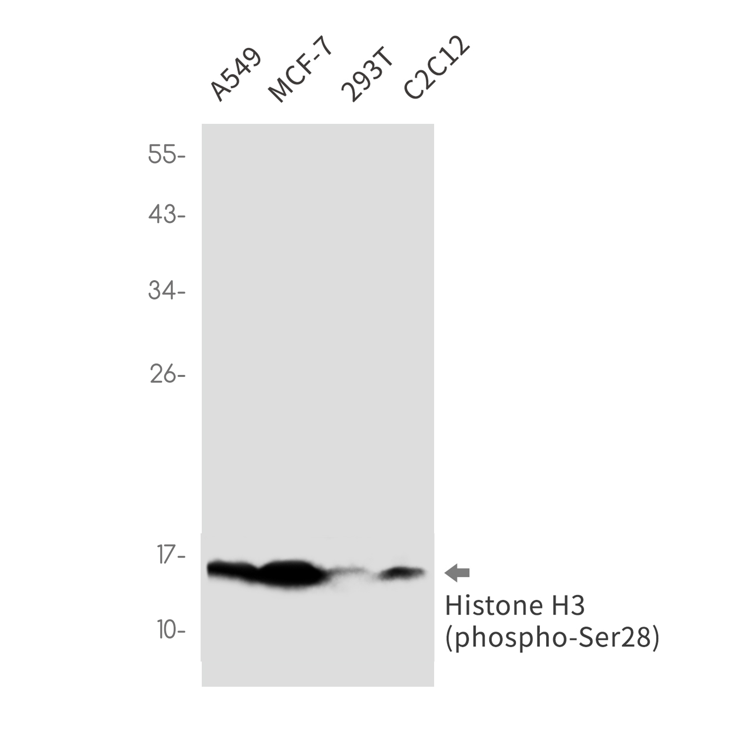 Rabbit Monoclonal Antibody to Phospho-Histone H3 (Ser28)