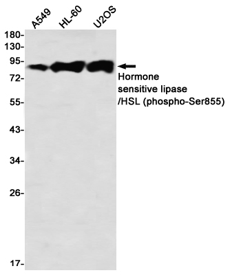Rabbit Monoclonal Antibody to Phospho-Hormone Sensitive Lipase (Ser855)