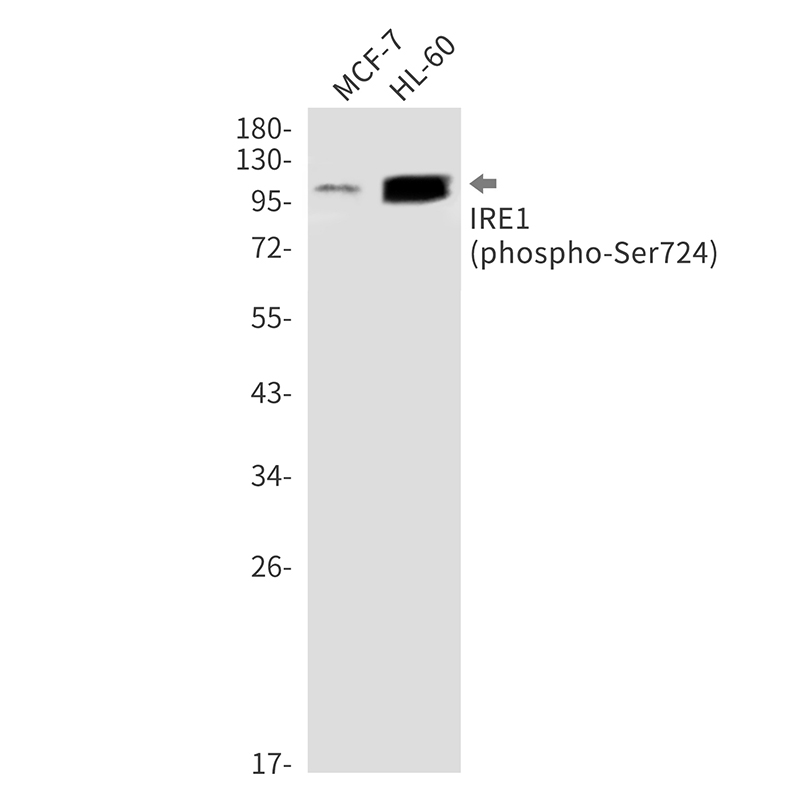 Rabbit Monoclonal Antibody to Phospho-IRE1 (Ser724)