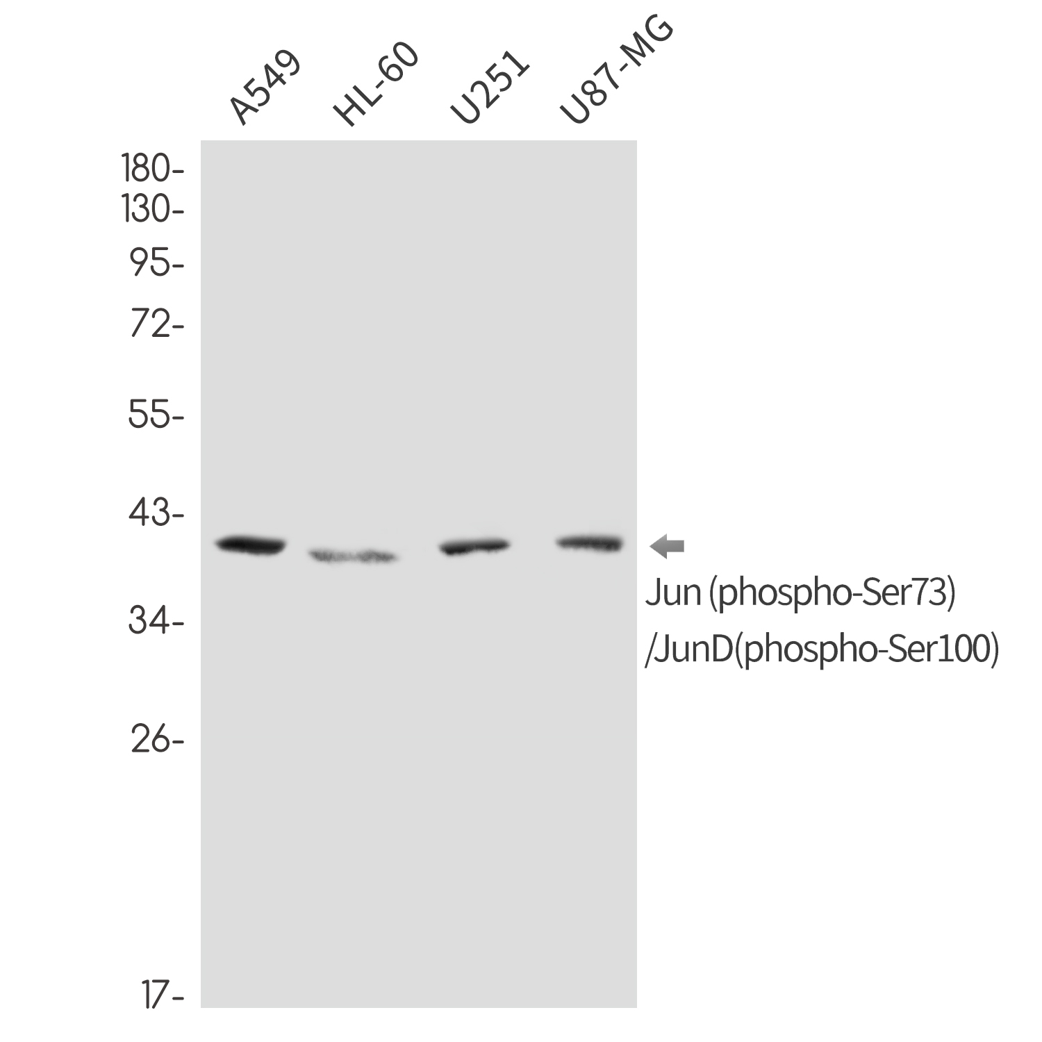 Rabbit Monoclonal Antibody to Phospho-Jun/JunD (Ser73/Ser100)