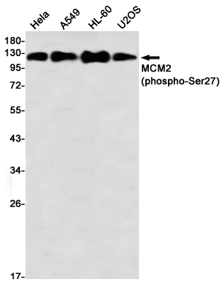 Rabbit Monoclonal Antibody to Phospho-MCM2 (Ser27)