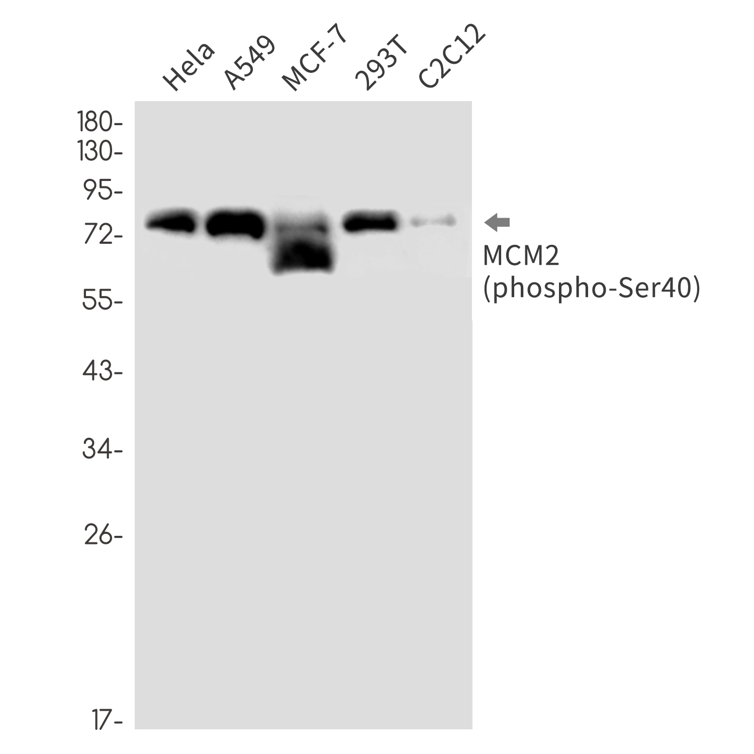 Rabbit Monoclonal Antibody to Phospho-MCM2 (Ser40)
