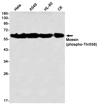Rabbit Monoclonal Antibody to Phospho-Moesin (Thr558)
