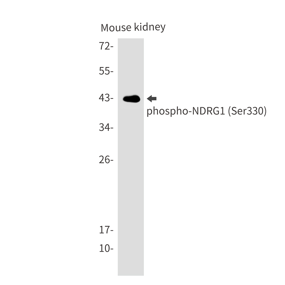 Rabbit Monoclonal Antibody to Phospho-NDRG1 (Ser330)