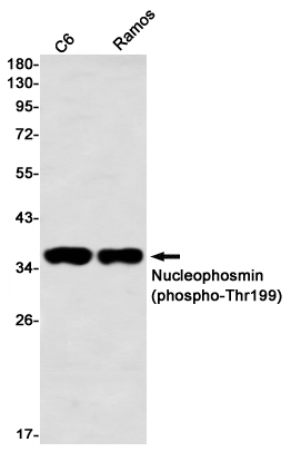 Rabbit Monoclonal Antibody to Phospho-Nucleophosmin (Thr199)