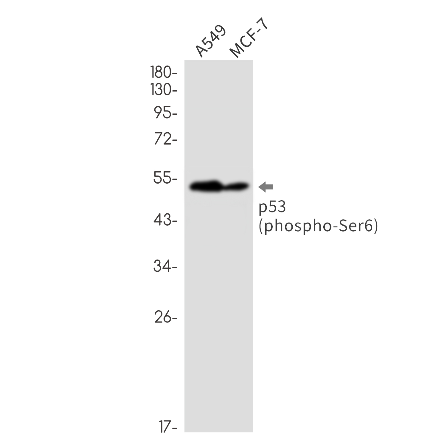 Rabbit Monoclonal Antibody to Phospho-p53 (Ser6)