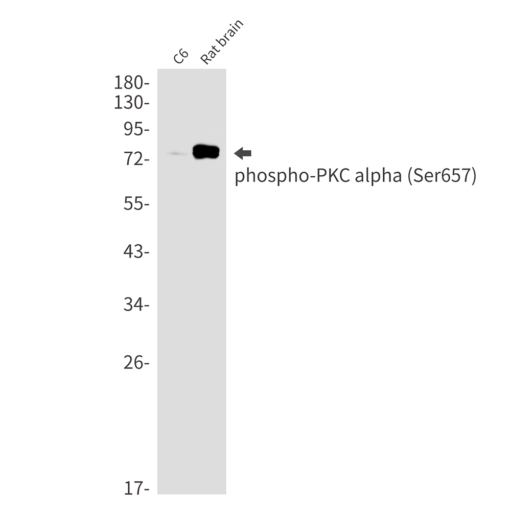 Rabbit Monoclonal Antibody to Phospho-PKC alpha (Ser657)