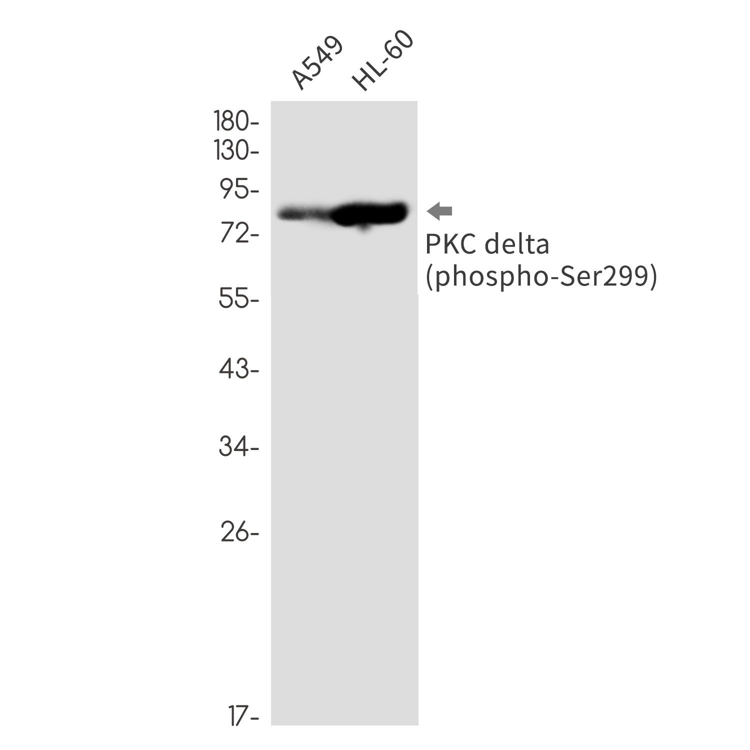 Rabbit Monoclonal Antibody to Phospho-PKC delta (Ser299)