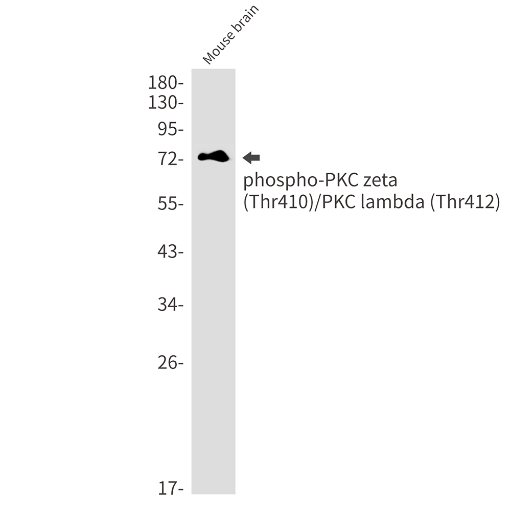 Rabbit Monoclonal Antibody to Phospho-PKC zeta/lambda (Thr410/Thr412)