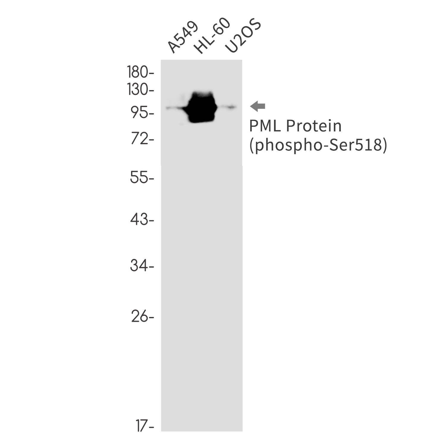 Rabbit Monoclonal Antibody to Phospho-PML Protein (Ser518)