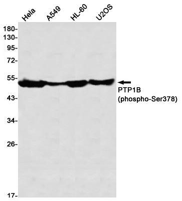 Rabbit Monoclonal Antibody to Phospho-PTP1B (Ser378)