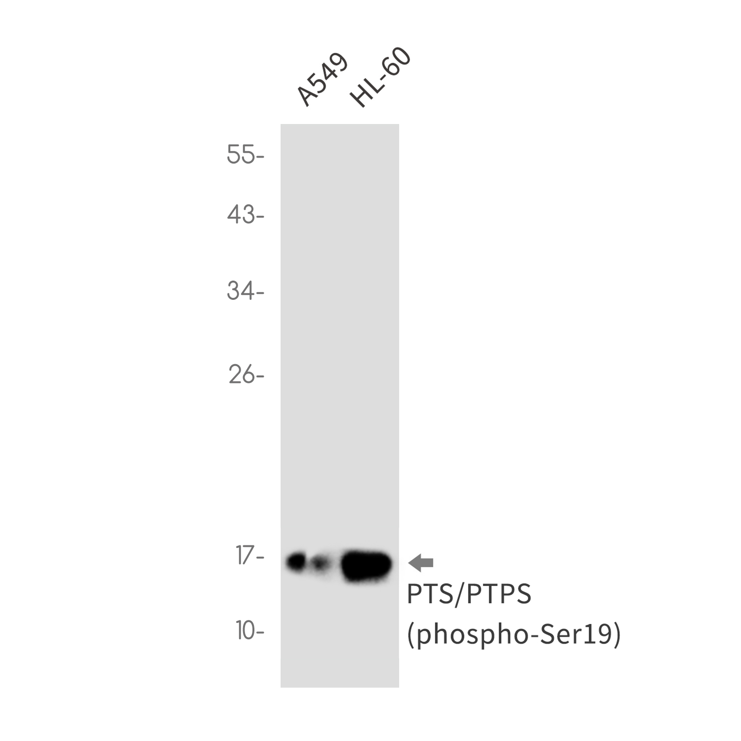 Rabbit Monoclonal Antibody to Phospho-PTS (Ser19)