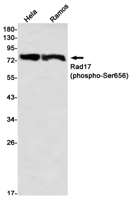 Rabbit Monoclonal Antibody to Phospho-Rad17 (Ser656)