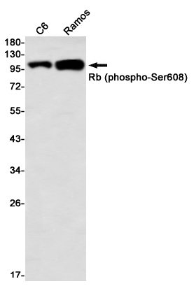 Rabbit Monoclonal Antibody to Phospho-Rb (Ser608)