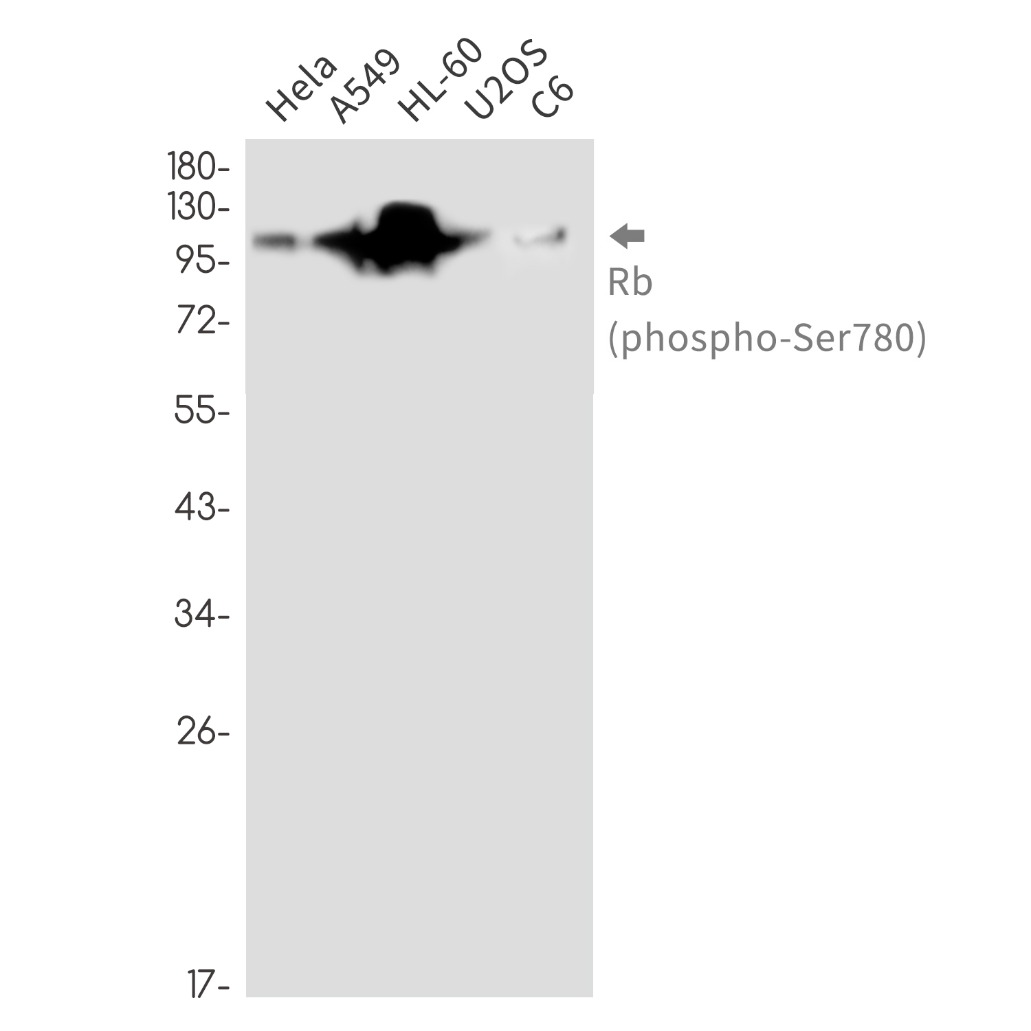 Rabbit Monoclonal Antibody to Phospho-Rb (Ser780)