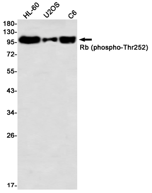 Rabbit Monoclonal Antibody to Phospho-Rb (Thr252)