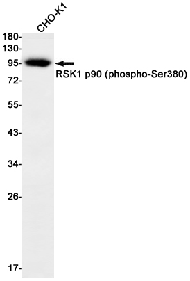Rabbit Monoclonal Antibody to Phospho-RSK1 p90 (Ser380)