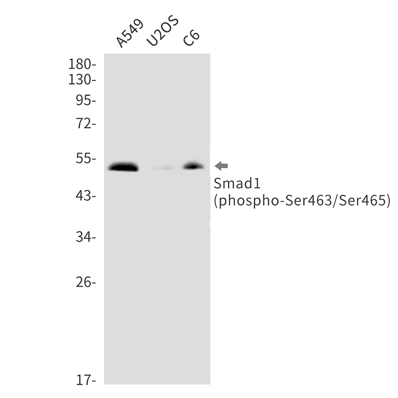 Rabbit Monoclonal Antibody to Phospho-Smad1 (Ser463/Ser465)